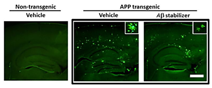 APP Transgeneic Amyloid Beta